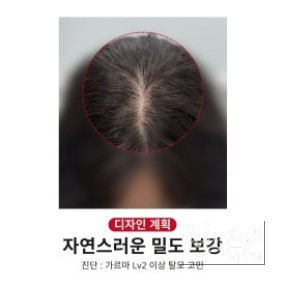 Consultation desk where clients receive detailed hair loss guidance