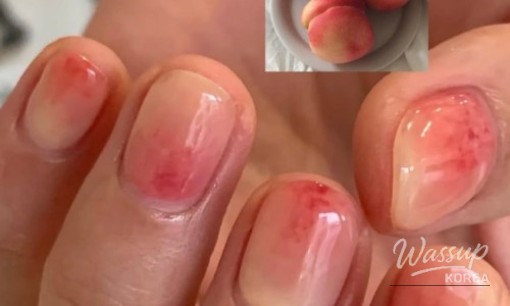 Freckles presented as a natural charm rather than a flaw